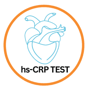 Diabetes Screening