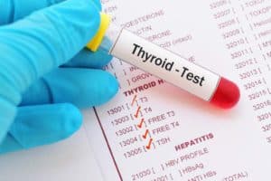 How To Get Diagnosed For Thyroid: Tests & Tips