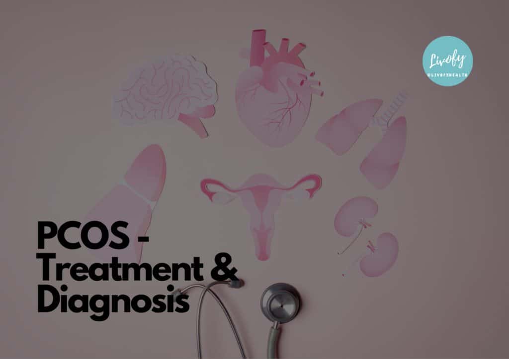 PCOS - Treatment & Diagnosis