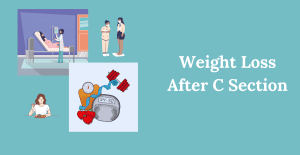Weight Loss After C Section